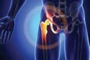 股関節痛の原因